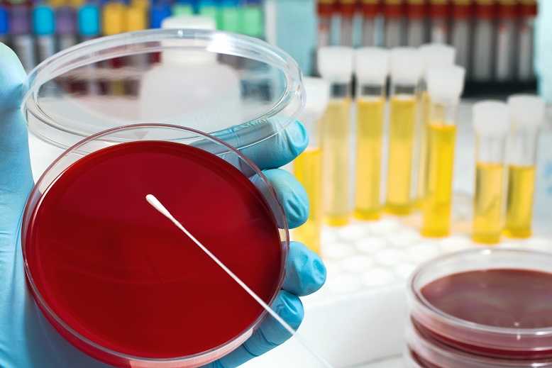 BREITNER Verpackungsmaschinen-Lösungen SIP – Sterilization in Place